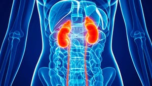 850 Millones De Personas En El Mundo Tienen Enfermedad Renal