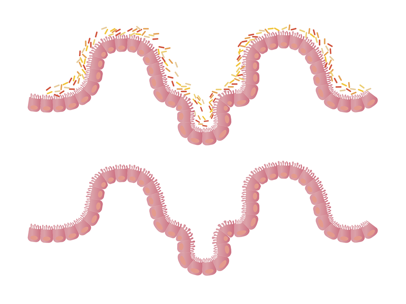 Cómo la dieta influye en las bacterias intestinales y la inflamación